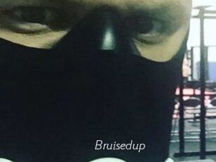 Bruisedup